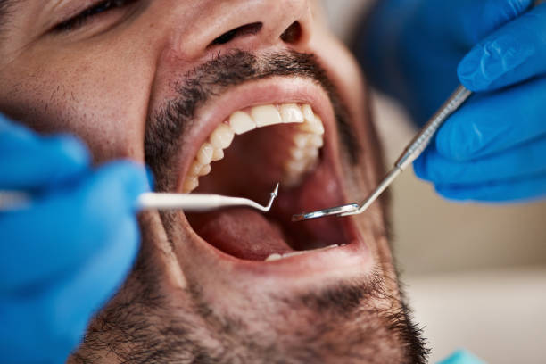 Best Emergency Tooth Extraction in Middlebury, IN