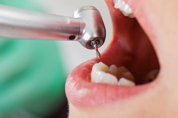 Best Emergency Dental Care for Trauma or Injury in Middlebury, IN